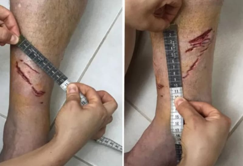 Pesquisadores do Instituto Argonauta confirmaram se tratar de um ferimento provocado por dentes de tubarão