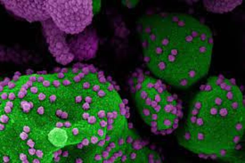 A capital paulista confirmou nessa segunda-feira (1&ordm;) o primeiro caso da variante XBB.1.16 da covid-19, também conhecida como Arcturus