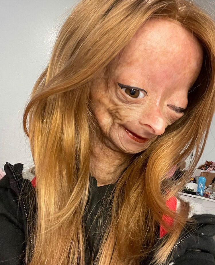 Adalia Rose Williams