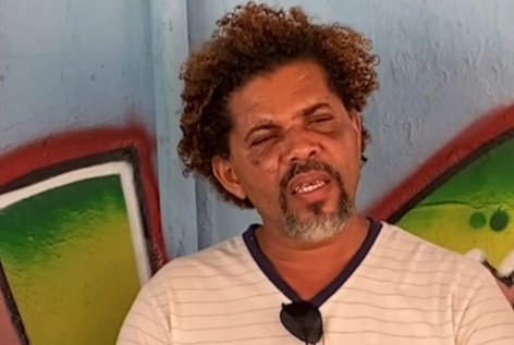 Morador de rua Gilvaldo Alves viralizou após polêmica