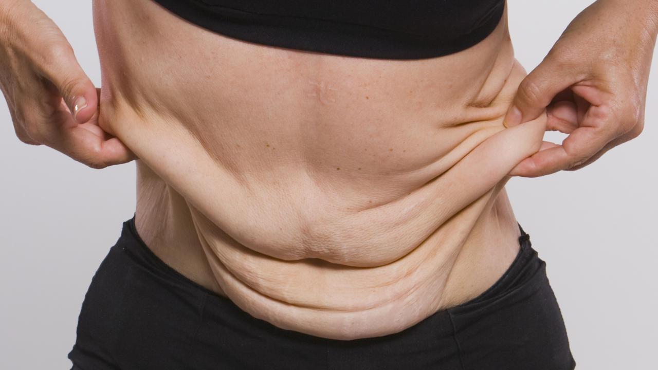 A flacidez pode ser causada tanto por fatores naturais quanto por alguns maus hábitos que desenvolvemos no nosso dia a dia