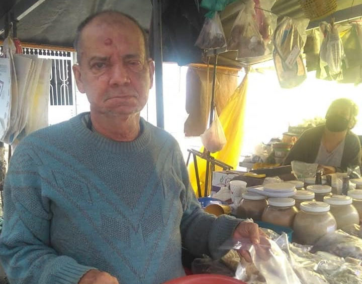 Mesmo com dores, o comerciante segue trabalhando nas feiras livres pela cidade de São Vicente