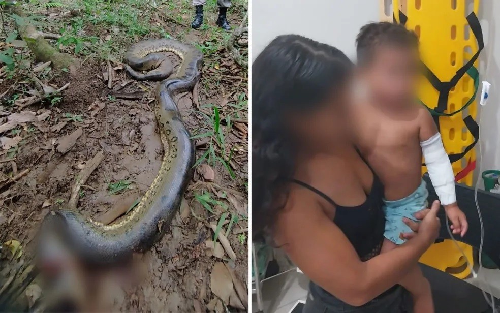 O menino estava brincando quando os pais ouviram gritos e foram até o local