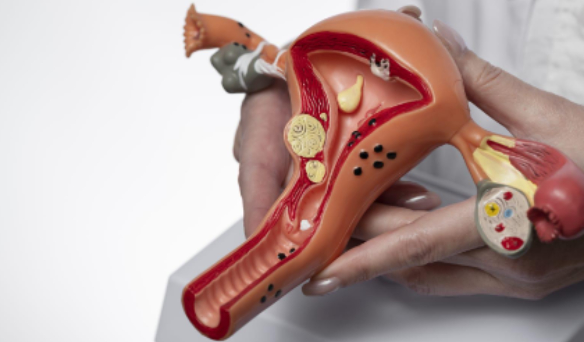 Veja dicas com a especialista no tema