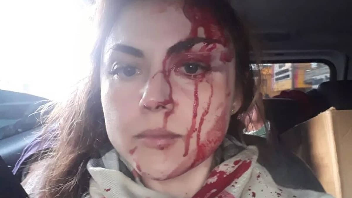 Gabriela Samadello Monteiro de Barros minutos depois de ser espancada