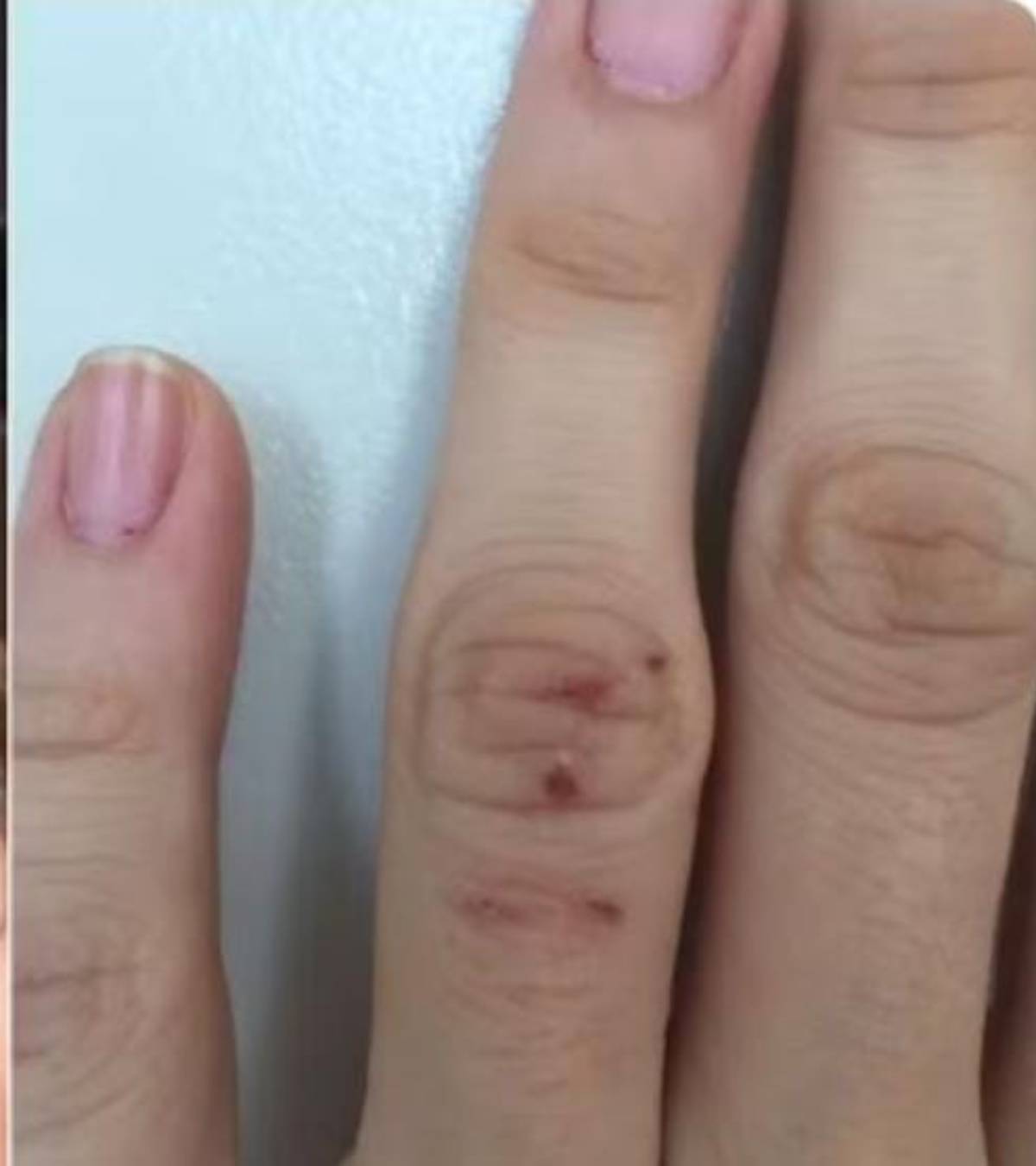 Cantora teve prejuízo de R$12 mil reais