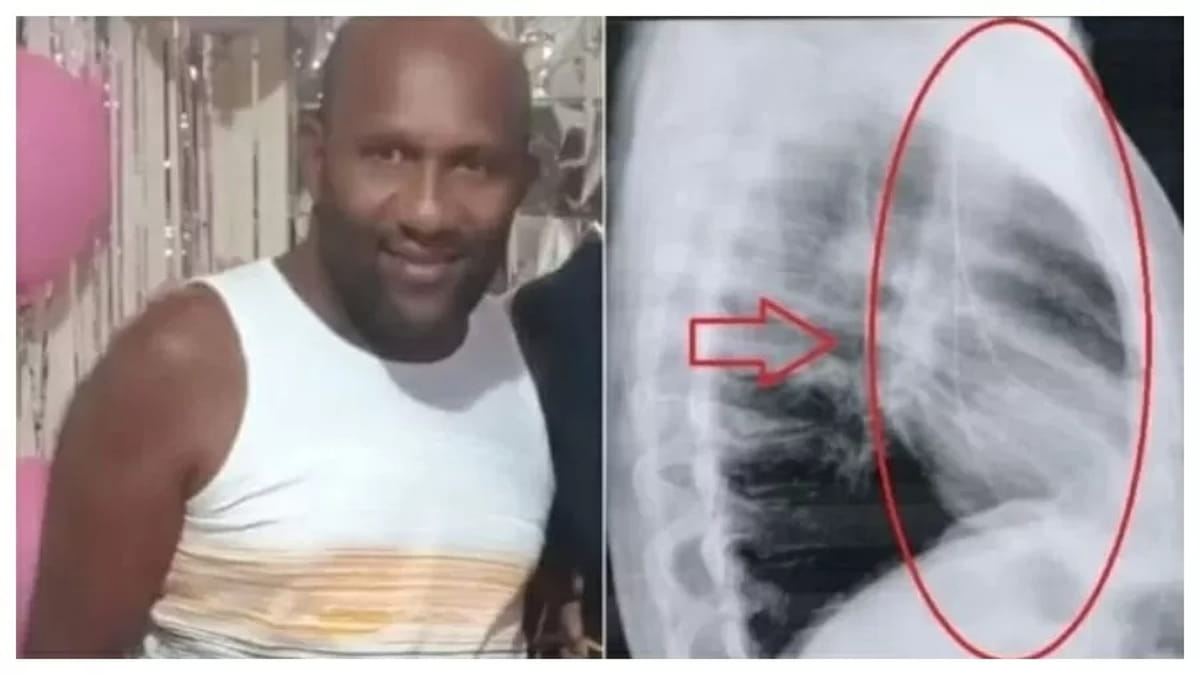 Vanes de Jesus da Silva, de 47 anos, é diabético e fazia tratamento por sofrer com insuficiência renal grave.