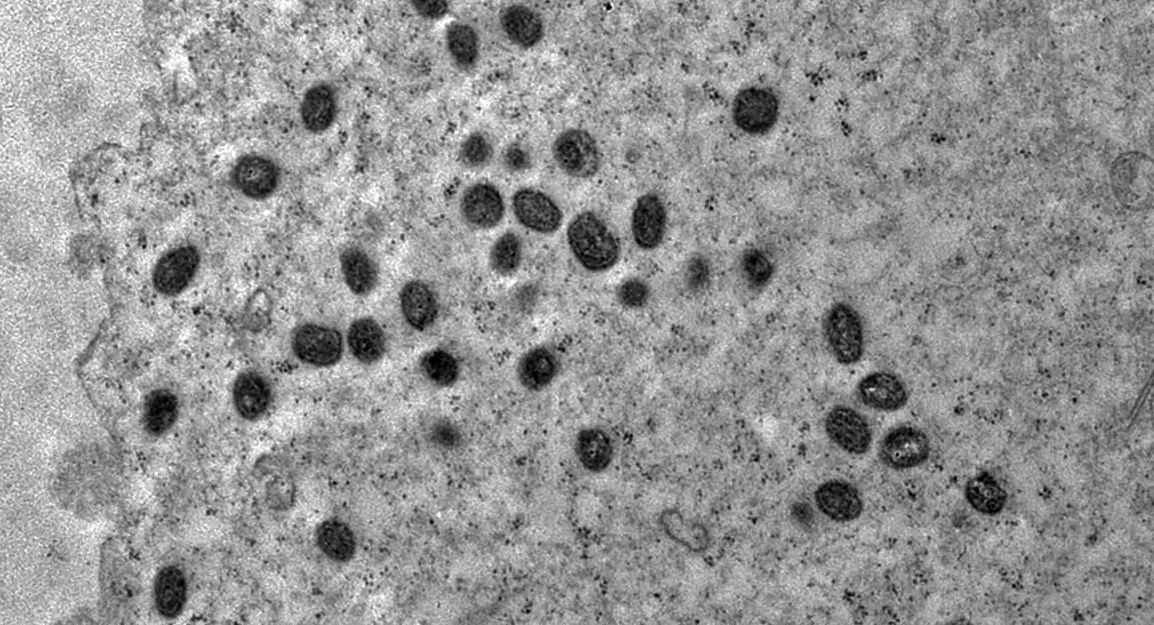 Segundo Ministério da Saúde, principal prevenção é evitar contato com pessoas com suspeita de contaminação