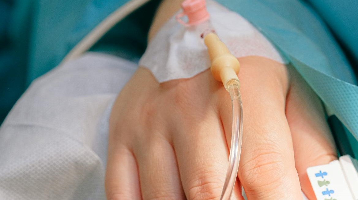 Escorbuto está voltando, mas não há motivos para muita preocupação