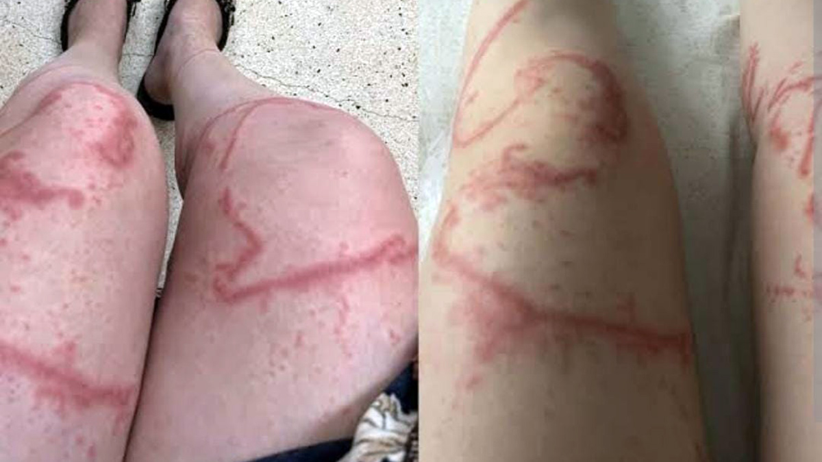 O acidente aconteceu em novembro de 2024