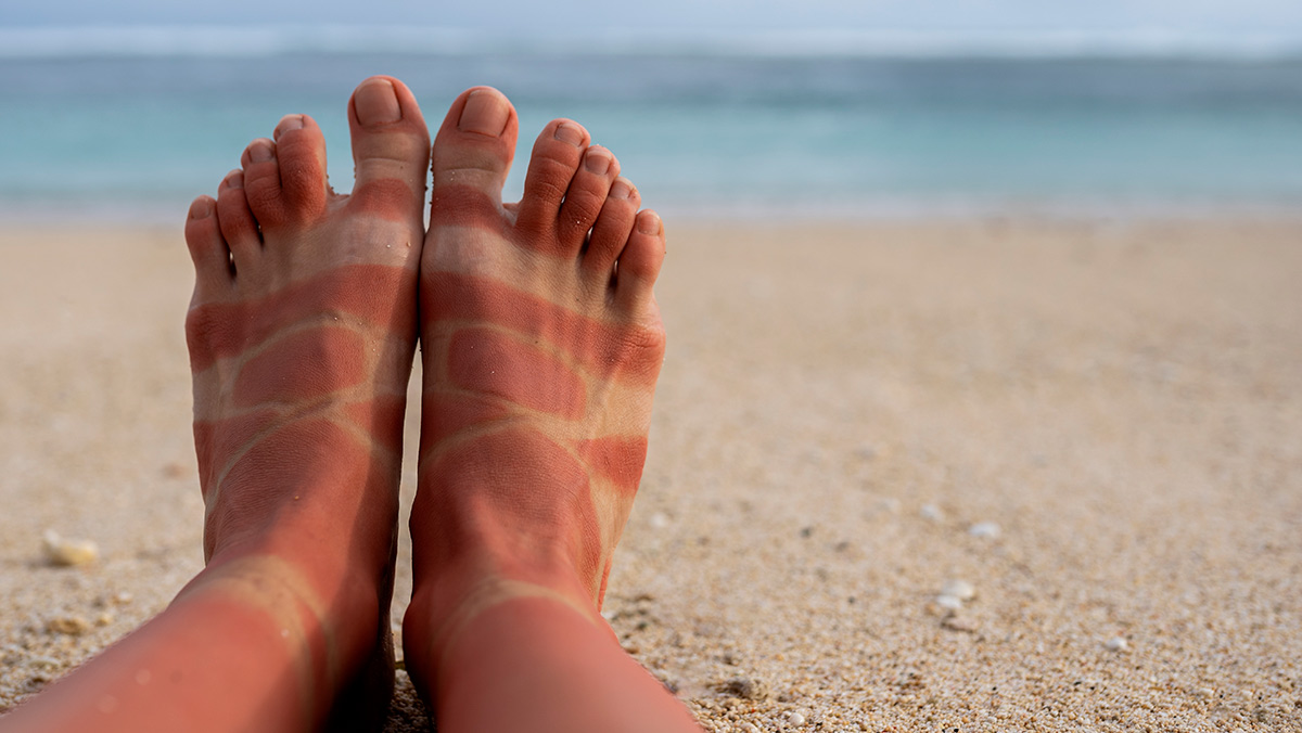 Mongaguá e Itanhaém são as cidades com mais praias que devem ser evitadas pelos banhistas