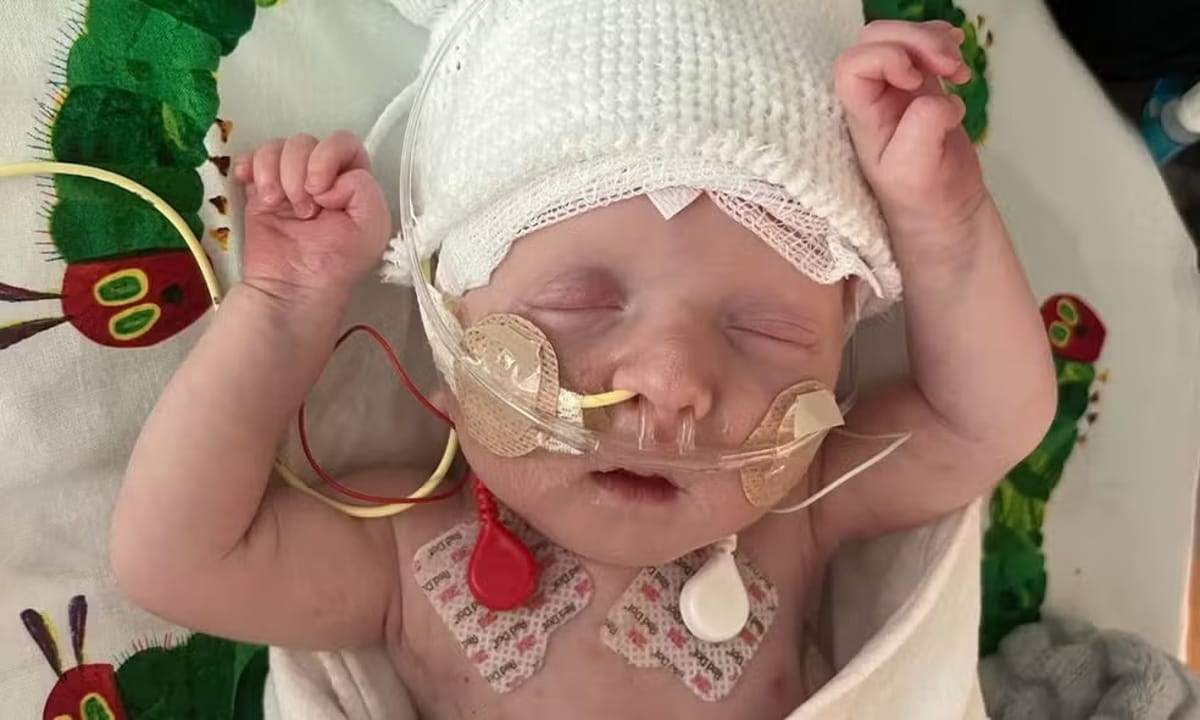 O bebê, agora com 9 meses e meio, tornou-se o primeiro paciente de qualquer idade a receber um tratamento personalizado de edição genética