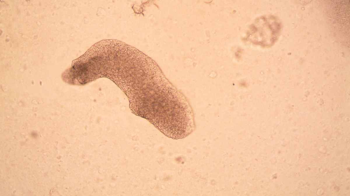 Desde o início da década de 1960, cerca de 97% dos casos registrados terminaram em morte