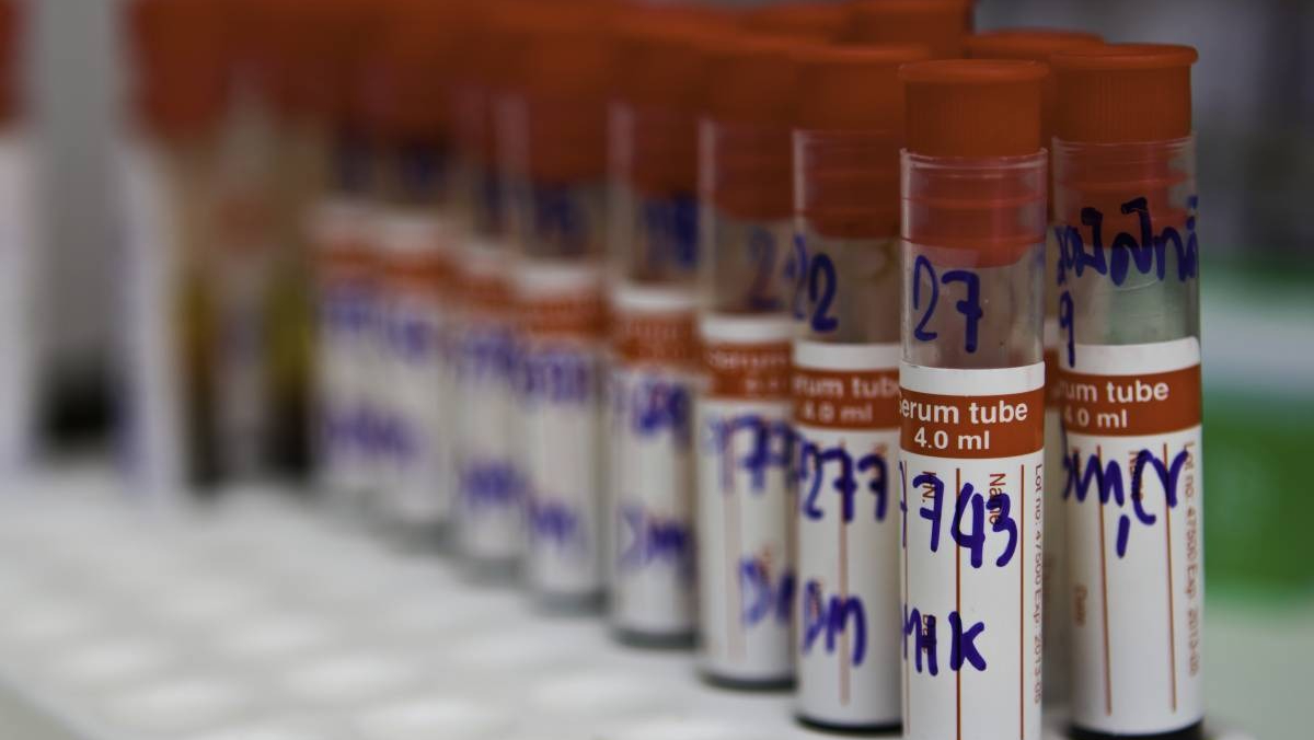 Essa mudança significativa é resultado de uma força-tarefa organizada pela Secretaria Municipal de Saúde