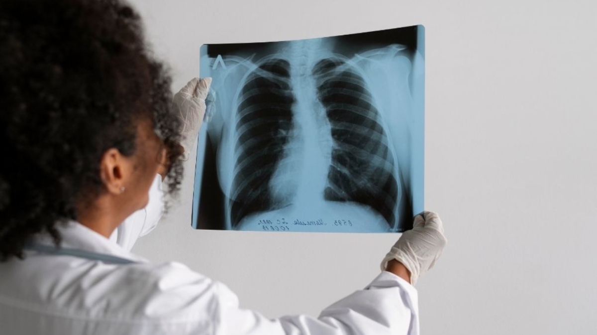 O tratamento segue o protocolo do Ministério da Saúde, com duração mínima de seis meses