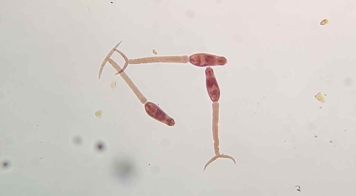 Novas pesquisas serão feitas para entender capacidade