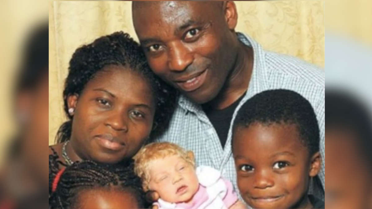 Como a genética humana pode surpreender com fenômenos raros.