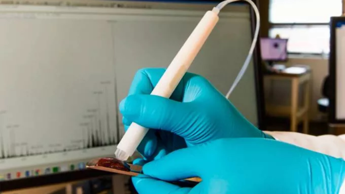 O equipamento identifica em tempo real se o tecido examinado é cancerígeno