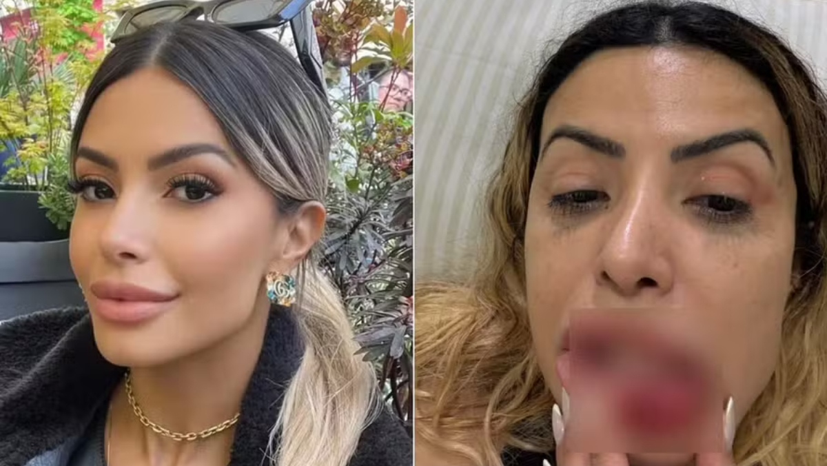 A denúncia foi feita após um episódio de violência ocorrido na madrugada desta quinta-feira (18)