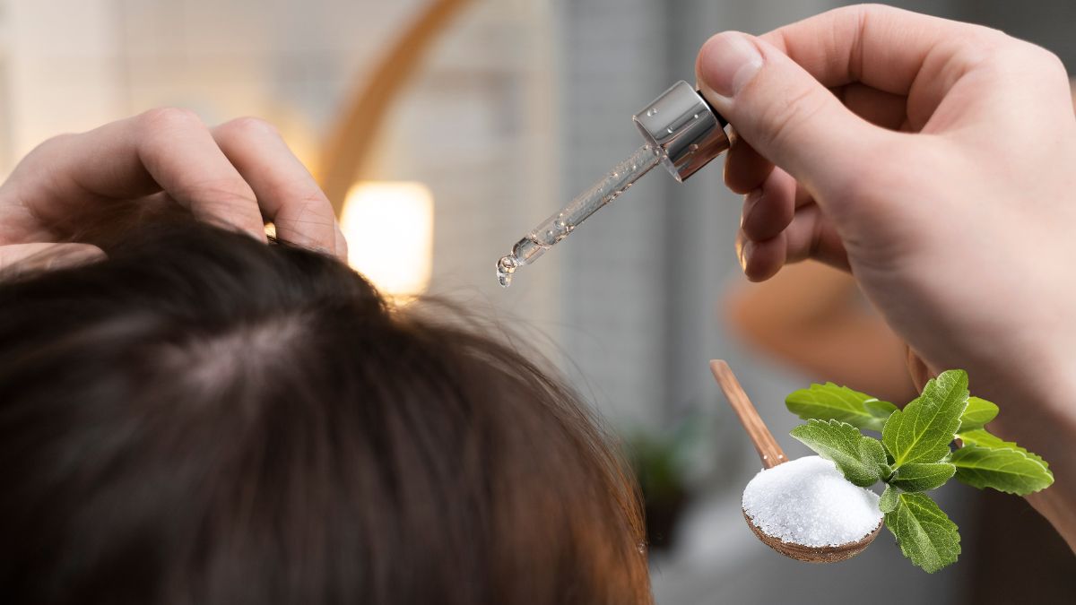 Microagulhas solúveis feitas com esteviosídeo e minoxidil penetram na pele sem dor e liberam o medicamento diretamente nos folículos capilares, estimulando o crescimento dos fios