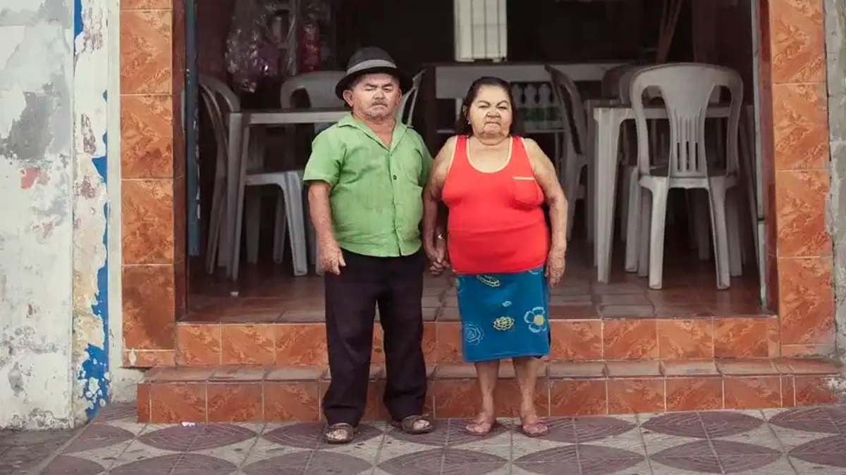 No interior de Sergipe, um pequeno município brasileiro ganhou destaque nacional e internacional por um motivo incomum: uma alta concentração de pessoas com nanismo.