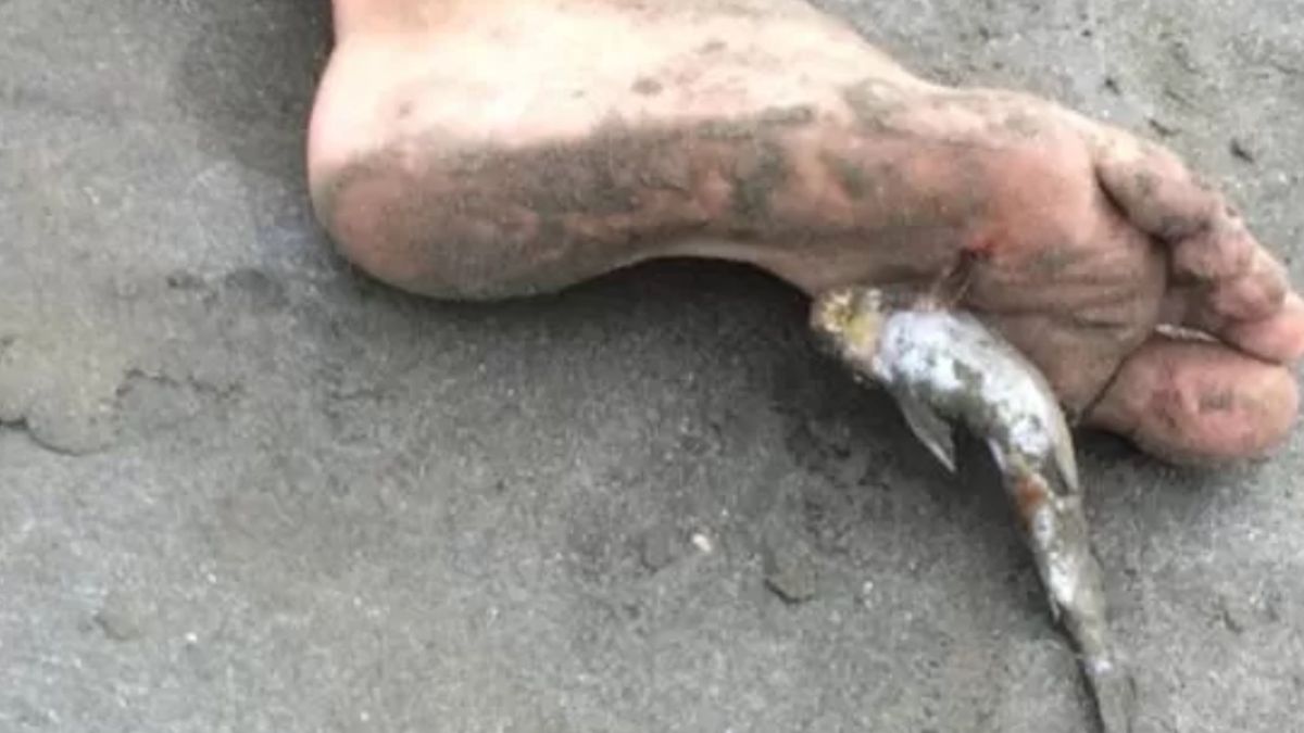 Fenômeno em praias paulistas acende sinal vermelho para banhistas; dor intensa e veneno preocupam autoridades.