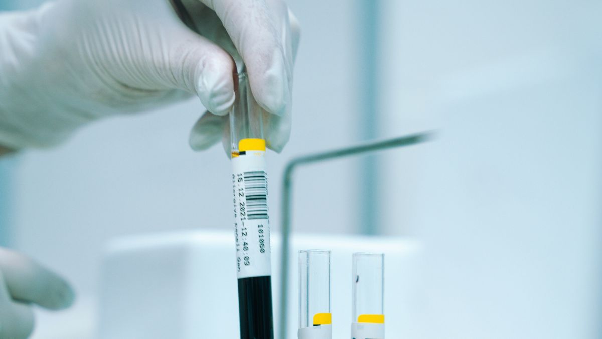 A hipocalemia consiste em uma alteração clínica pela baixa concentração de potássio no sangue, reforçando a importância do elemento