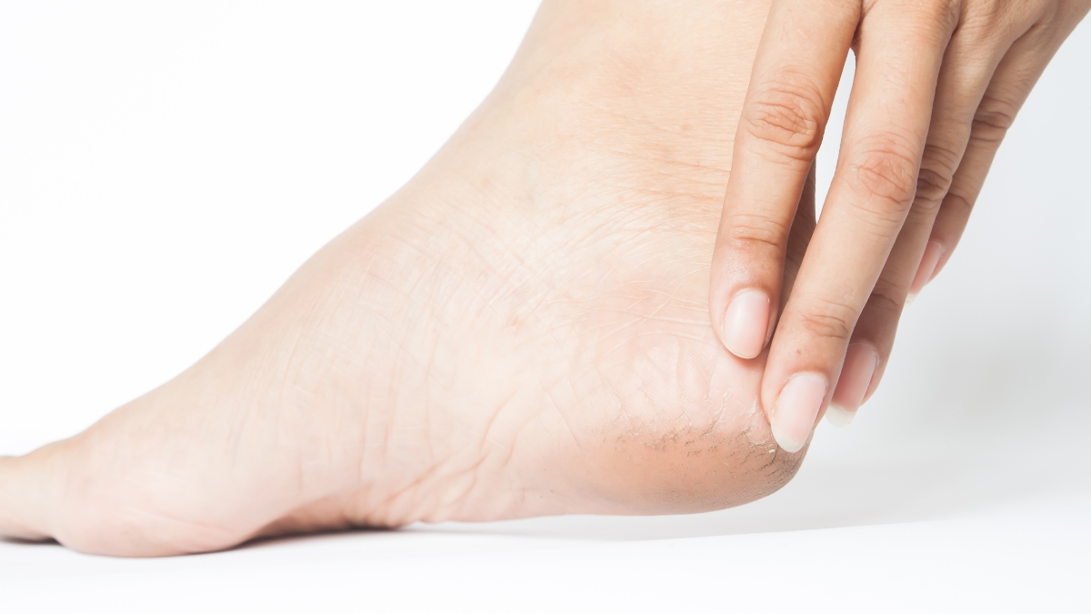 A pele da sola dos pés costuma perder umidade mais rapidamente do que outras áreas do corpo