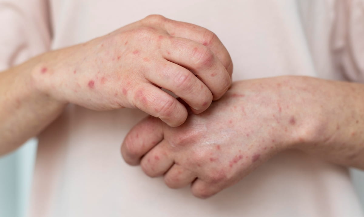 Em comparação com 2024, quando foram registrados apenas 446 casos, o aumento chega a dezenas de vezes