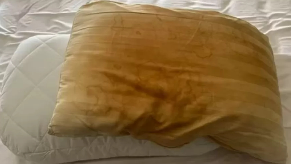 Especialistas alertam que a descoloração costuma indicar acúmulo de umidade dentro do travesseiro