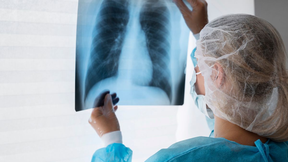 Entenda como a bactéria da tuberculose engana o sistema imunológico e permanece escondida no corpo por décadas